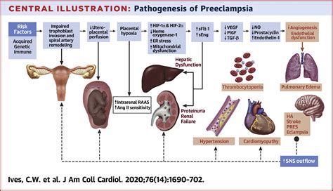preeclampsia pathophysiology